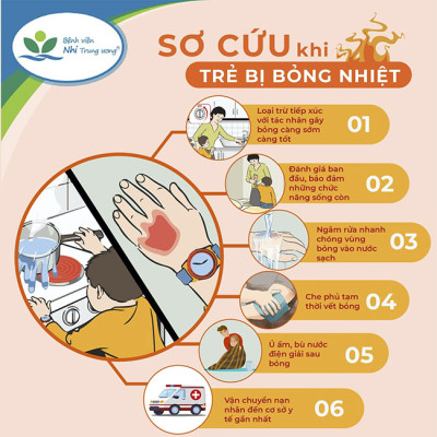 Cách xử lý khi trẻ bị bỏng