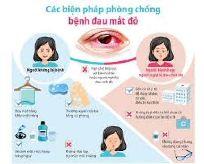 BỆNH ĐAU MẮT ĐỎ